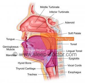 sleep diagram 2regions 300x293 - Drug-Induced Sleep Endoscopy: Recent Educational Programs