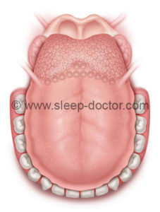 can you choke on a loose tooth while sleeping