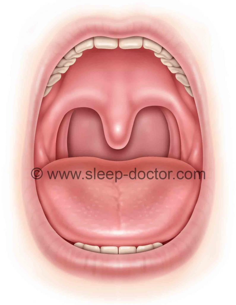 Palatoglossal Fold