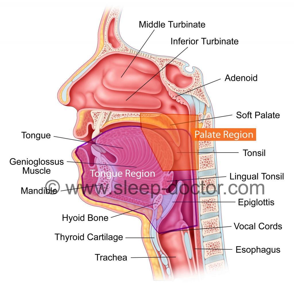 sleep diagram 2regions 1024x999 - Personalized Sleep Surgery Is Better Sleep Surgery